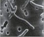 Bloodborne pathogens microscopic view of bloodborne pathogens